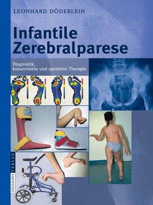 cover image of Infantile Zerebralparese